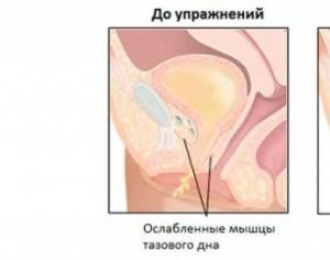 Секреты «пукающей вагины» или почему выходит воздух из матки Почему в матке собирается воздух